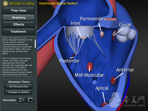 3D Road Map to ASD & VSD下载(iPad医疗)攻
